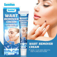 New wart removal cream