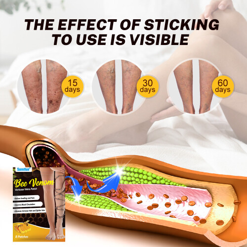 Bee Venom Vein Care Patch Varicose Veins Earthworm Leg Massage Heating Patch 2