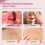 Acnecrème Calamine Huidverzorgingscrème 4