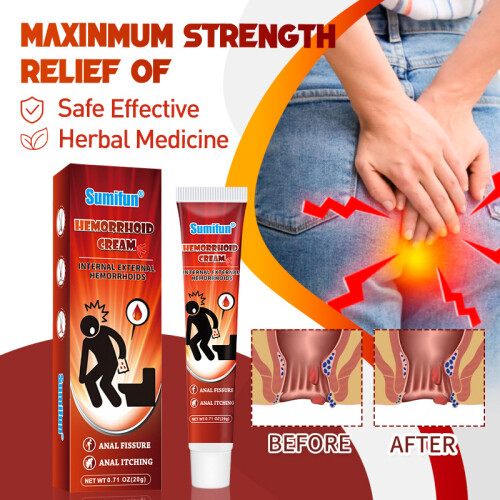 Aambeien Crème Aambeien Gezondheidszorg Crème 2