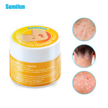 10g Ringworm King Cream Is An External Ointment For Itchy Hands And Feet And Inner Thigh Skin.
