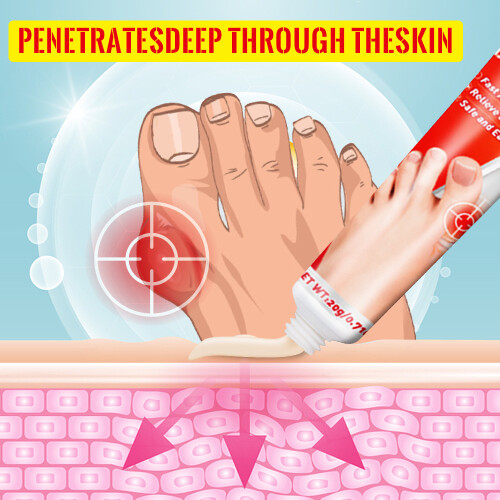 Bunion Cream Joint Massage Care Cream 1
