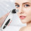 Instrument Negative Pressure Suction Portable Blackhead Instrument(White) 1