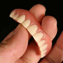 Facetas Dentárias Encaixáveis: Sorriso Instantâneo, Próteses Dentárias Estéticas