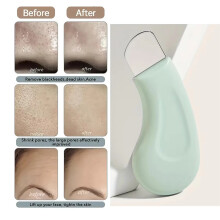 Blackhead and Whitehead Removal Tool for Nose and Face - Skin Pore Cleaner