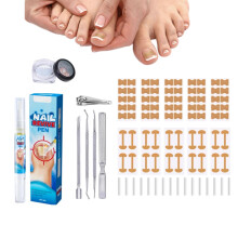 Ingrown Toenail Removal Kit with Corrector Drops and Tools, Professional AtHome Treatment Set