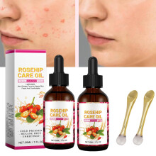 Rosehip Face Oil for Women 2pcs, Organic Rosehip Seed Oil for Face and Hair, Deep Hydration Formula