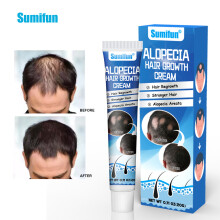 (A) Alopecia Areata Cream Set Scalp Nutritional Health Care Cream