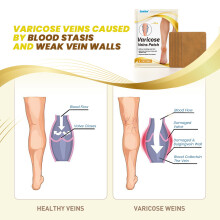 Vein Health Care Tiemaikang