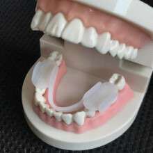 Teeth Grinding Mouth Guard for Bruxism - Night Guard and Clenching Relief Aid