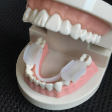 Bruxism Mouth Guard Sleep Mouthguard Splint Clenching Dental Alignment Trainer Sleep Aid Teeth Protector Tools Ls
