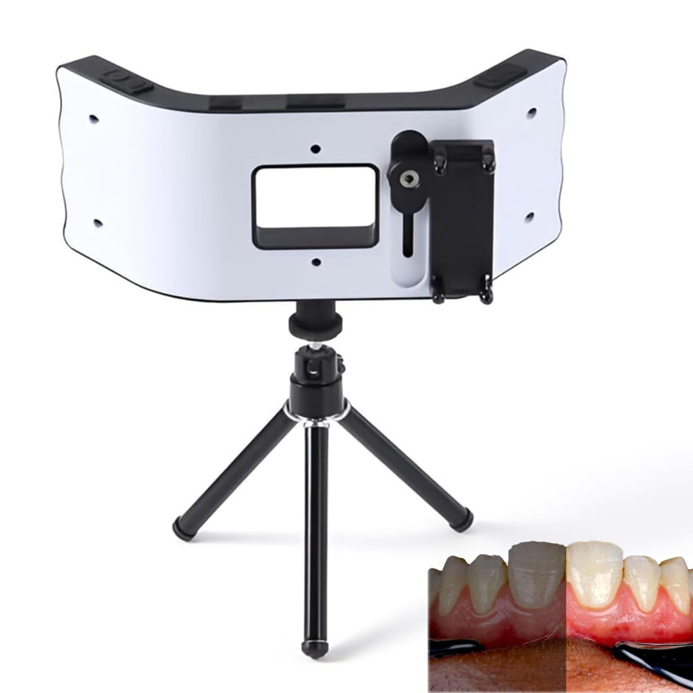 Dental Photography 60006500K With Tripod, Mobile Phone Macro Fill For Dentist And Jewelry Light 9330225698890