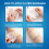 Wound Protection Patch Silicone Gel Dressing Wound Care Patch 5