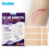 Scar Patch Small Area Scar Care Patch 2