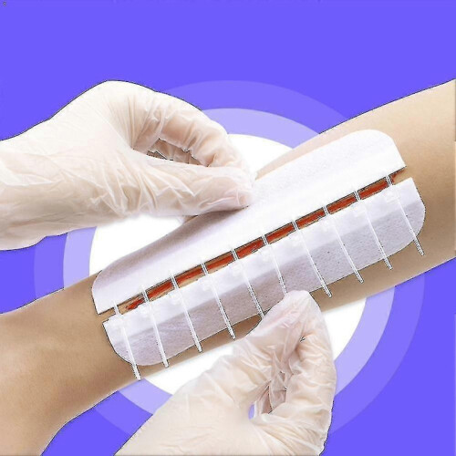 Zipper Band-aid Painless Wound Closure Device - 4/10pcs Pack