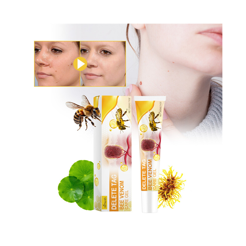 20G Bee Venom Care Gel For Body Skin Tag Care Mole Corn Wart Hands And Feet