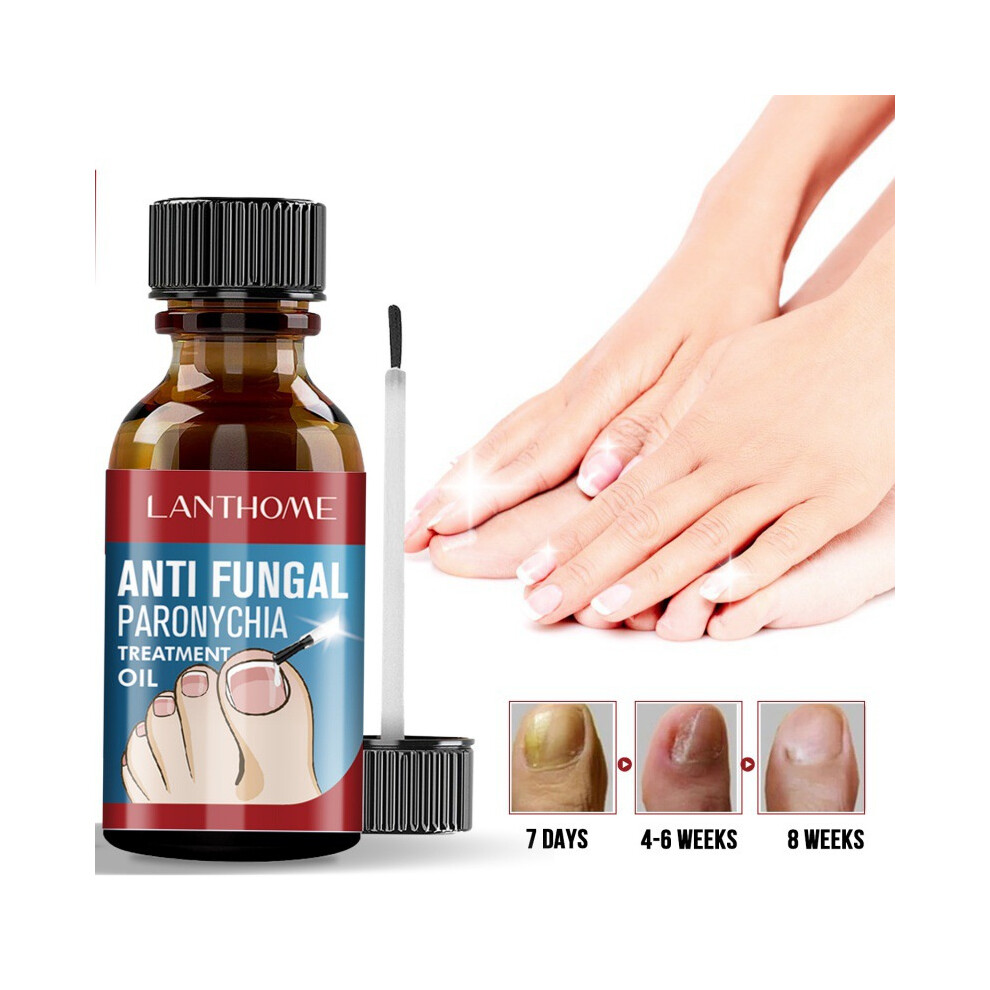 10ml Fungal Nail Renewal Treatment for Toenail & Nail Repair - Effective Fungus Remover