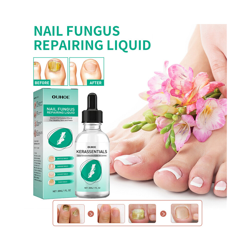 30Ml Nail Fungus Repairing Liquid Serum For Toenail Fungus Treatment Infection 110691512987