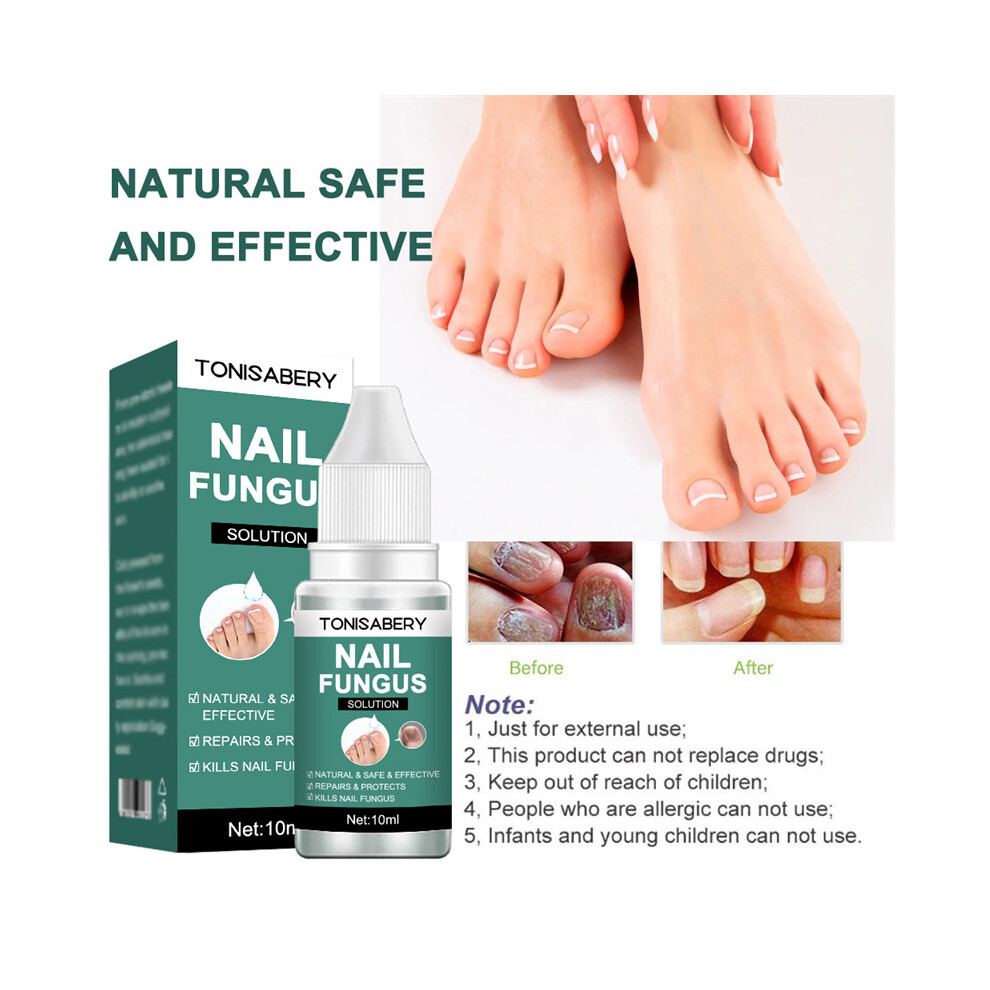 10ml Anti-Fungal Nail Serum for Fingernail & Toenail Infection Treatment