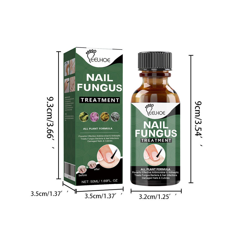 (50ml) 30/50ML Nail Fungal Treatment Antibacterial For Toe Finger Nail Fungus Infection