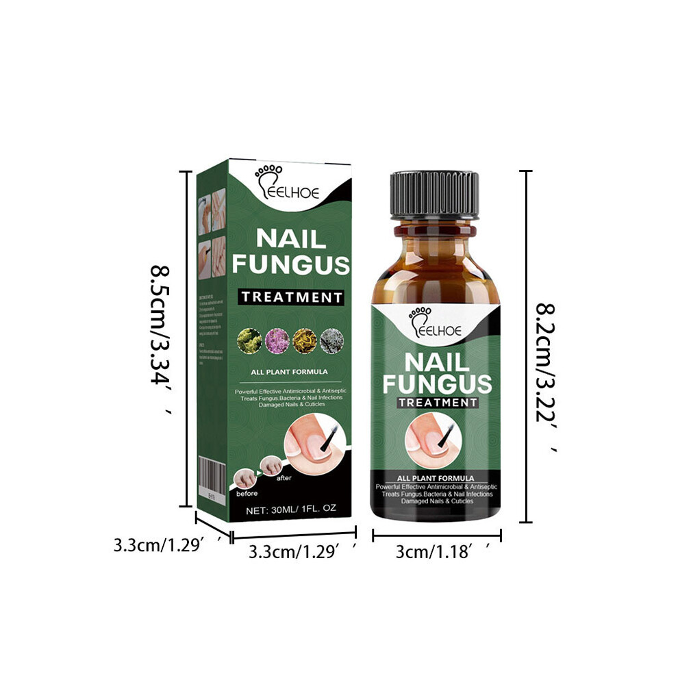 (30ml) 30/50ML Nail Fungal Treatment Antibacterial For Toe Finger Nail Fungus Infection