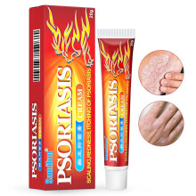 20G Eczema Dermatitis Psoriasis Skin Gel Cream For Redness Itching Of Psoriasis