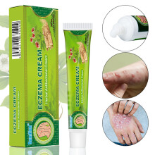 20G Eczema Cream Herbal Antibacterial Ointment Treatment Anti-itching Relief Gel