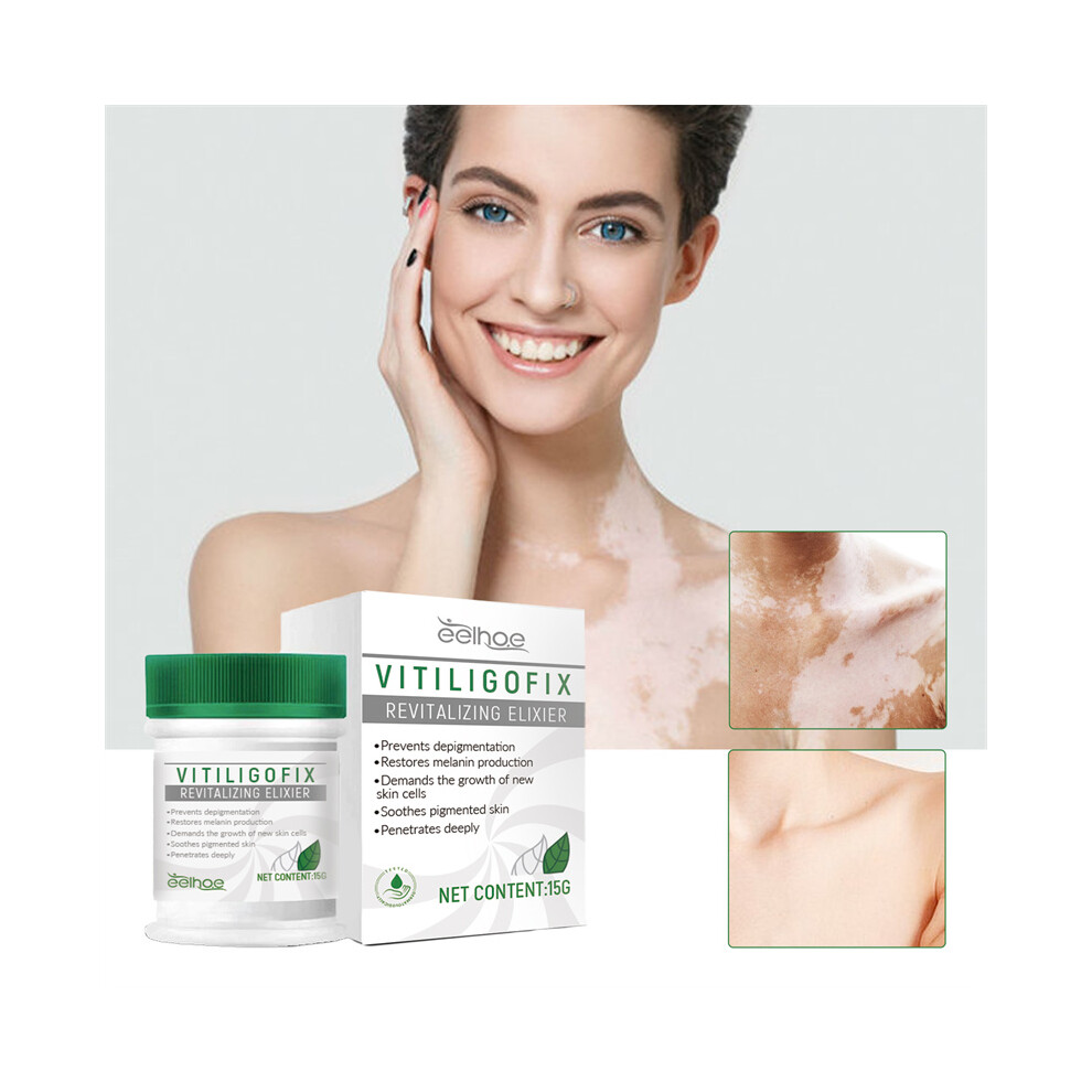 Vitiligo Soothing & Repair : Fix, Treat & Revitalize Elixir Cream 413590200826
