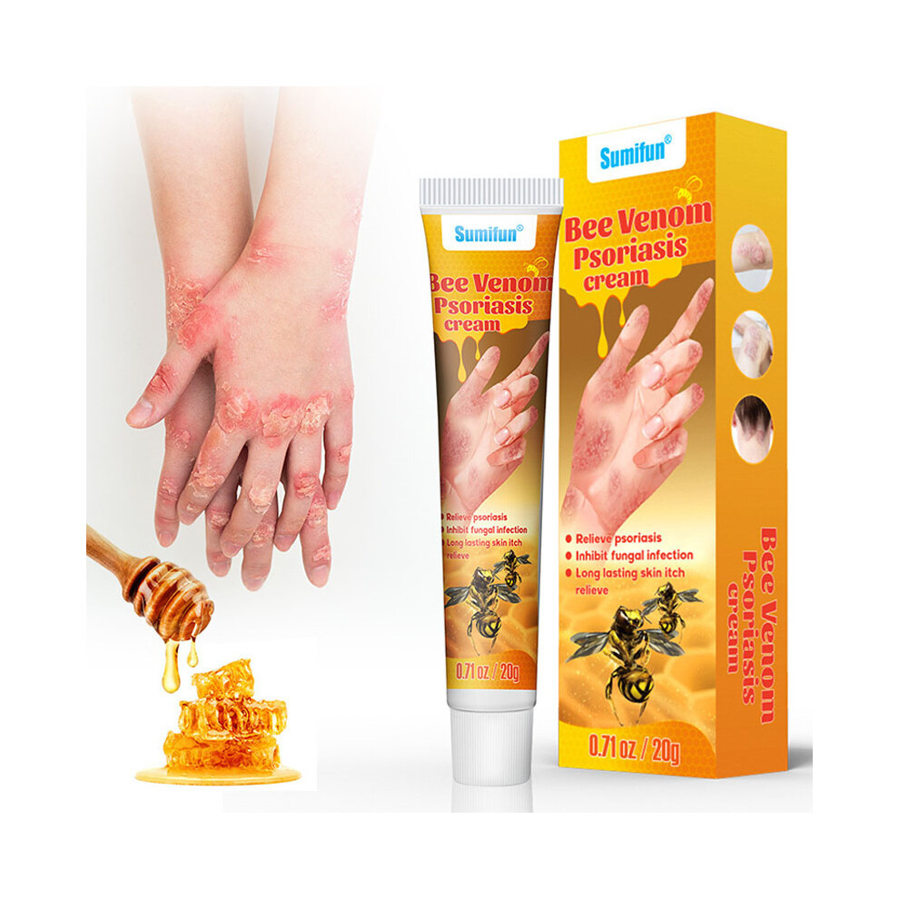 Cream 20G Bee Venom Psoriasis For Relieve Dermatitis Psoriasis Itchy Skin