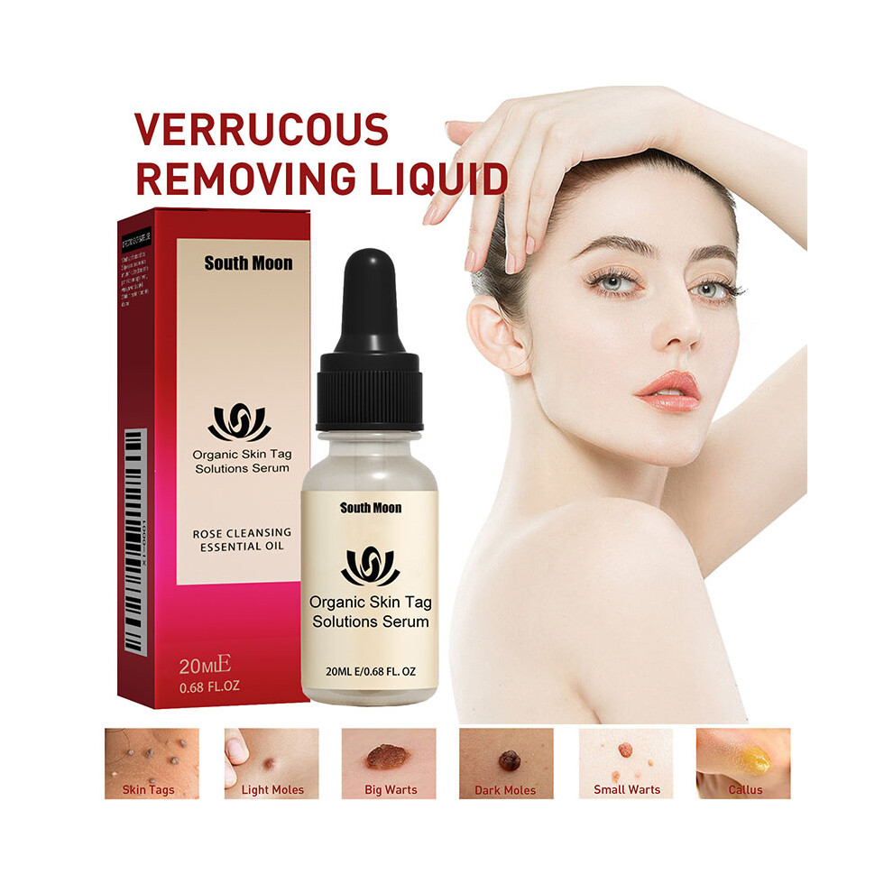 20ML Verrucous Wart Remover Liquid Skin Tags Mole Remover Eliminate Foot Corn Wart