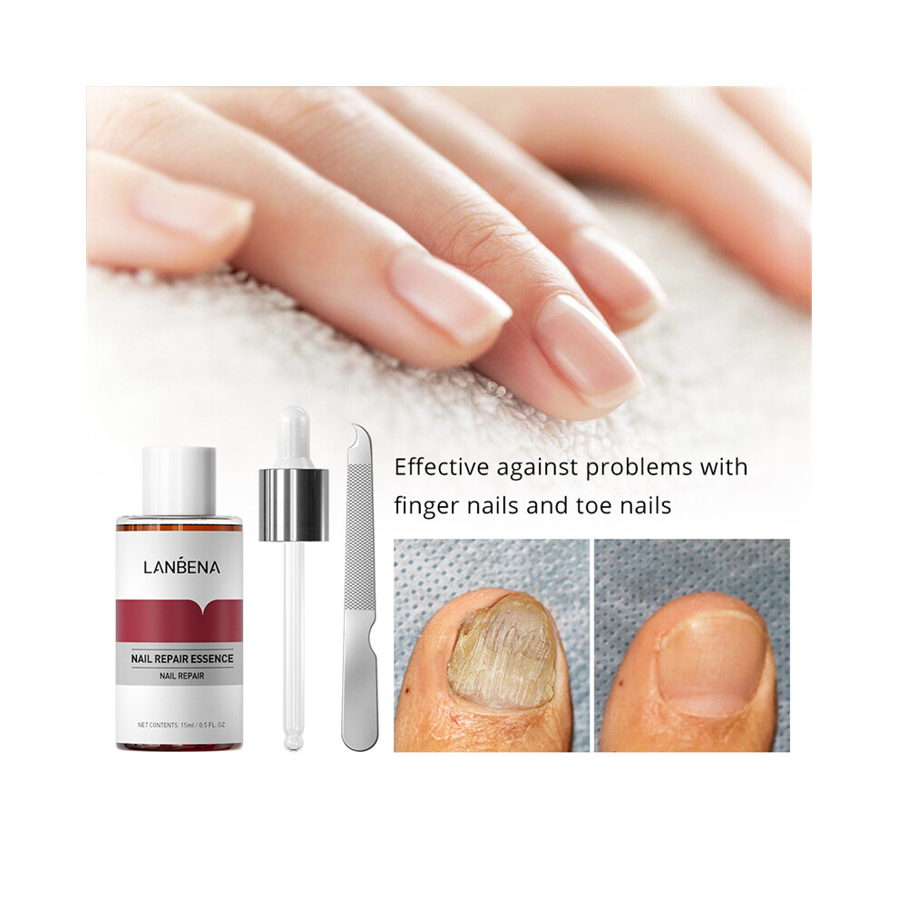 15ML Nail Repair Serum+Tool Set Fungal Nail Treatment Liquid Toe Essence