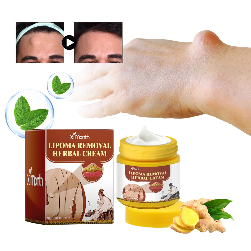 Cream 20G Lipoma Removal Plant Extract Treat Skin Swelling Ointment Relief