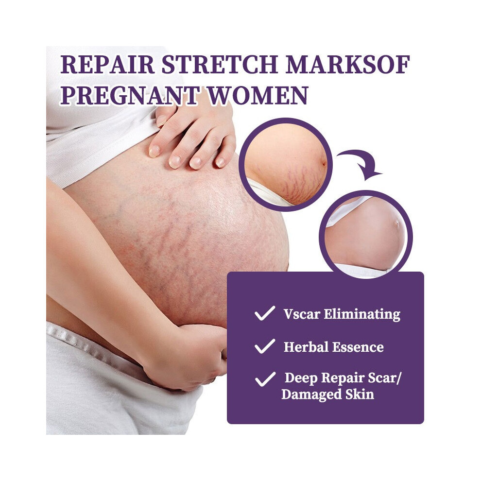 Cream 30Ml Scar Gel Stretch Marks Removal Surgery Scar Skin Care