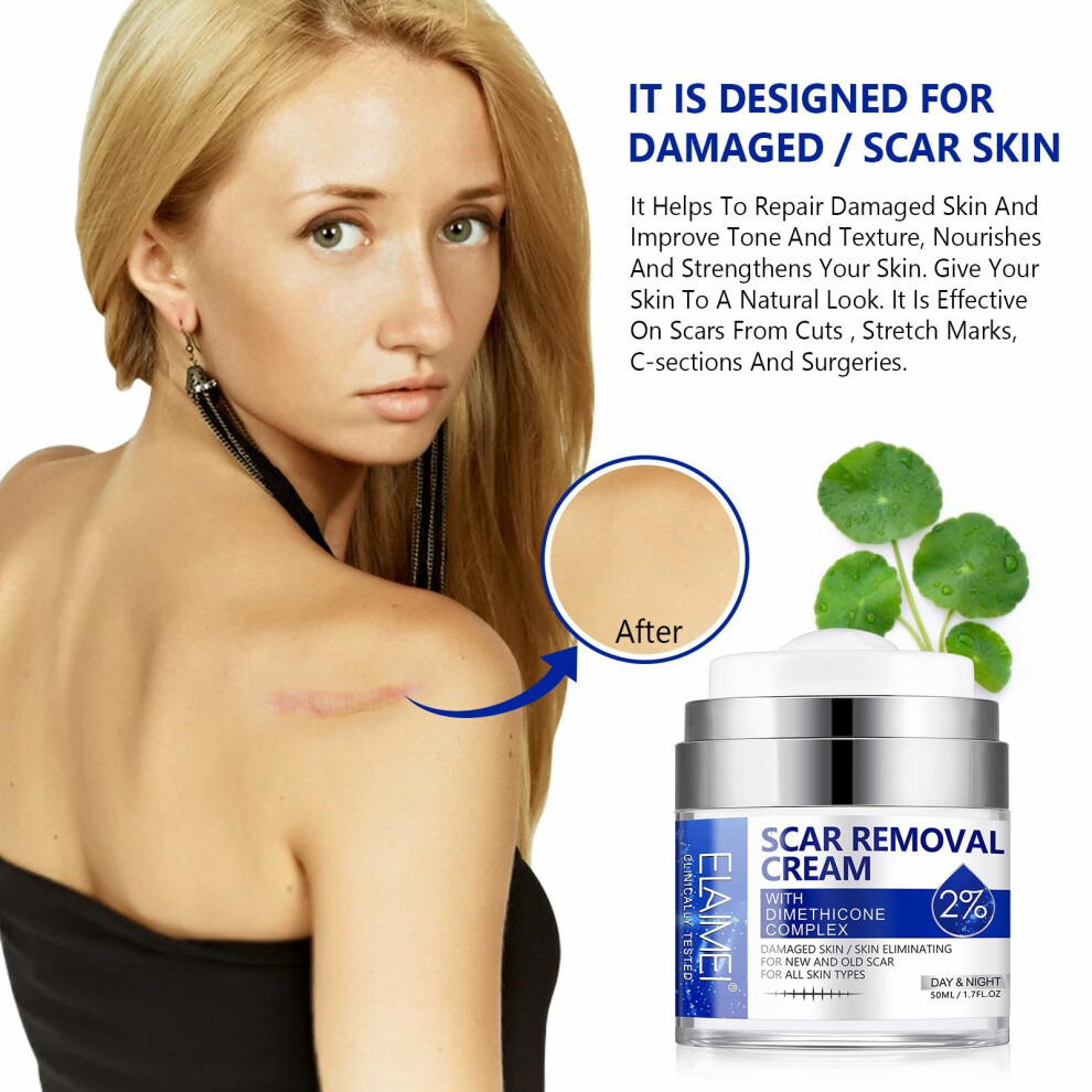 50ML Scar Removal Cream Rapid Repair of New & Old Scars