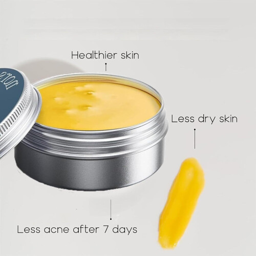 Norse Organics Acne and Redness Killer 1