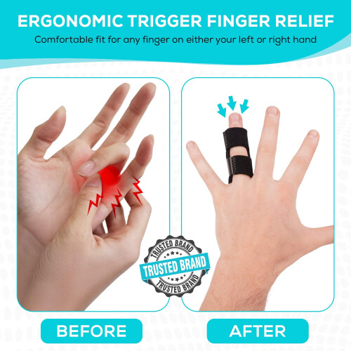Trigger Finger Splint Adjustable Finger Support Brace Small Size Aluminum 3 Pack Neoprene Breathable 2
