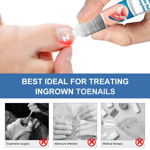 Jiagoukang Cream Nail Treatment Cream 1