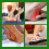 Heel Care Patch Heel Massage Care 4