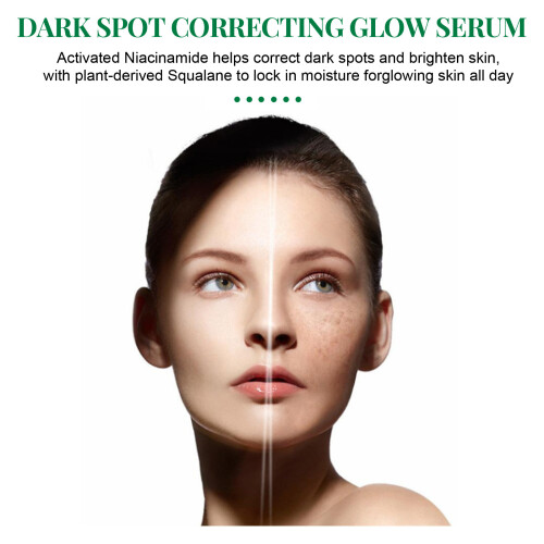 Dark Spot Correcting Glow Serum Beauty Hyperpigmentation Dark Spot Remover 1