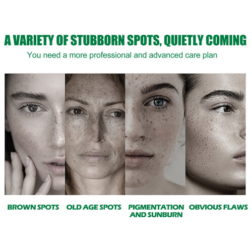 Dark Spot Correcting Glow Serum Beauty Hyperpigmentation Dark Spot Remover 2