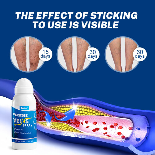 Intravenous spray Mailisu spray 2