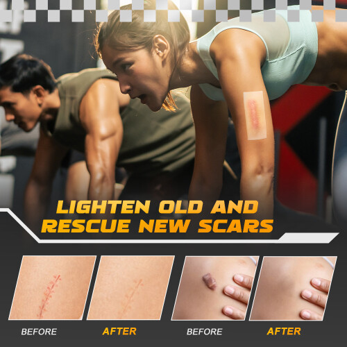 Scar Patch Silicone Gel Scar Care Patch 1