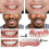 Comfortable silicone tooth veneers for braces - extra thin orthodontic hide 4