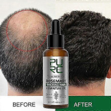 2025 Purc Rosemary Hair Care Essential Oil Mint Ginger Hair Care Scalp Hair Care Essential Oil