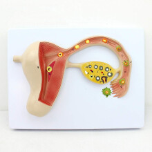 Fetal Development Model with Uterine CrossSection and Removable Parts for Classroom Teaching