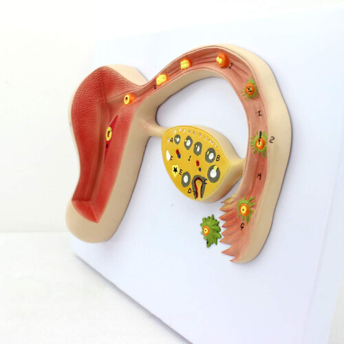 Fetal Development Model with Uterine CrossSection and Removable Parts for Classroom Teaching 2