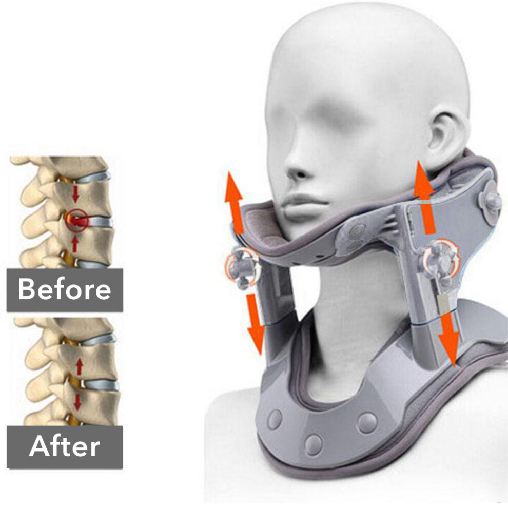 Neck Traction Device For Adjustable Spinal Alignment In Households_Special Gift