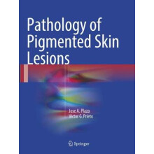 Pathology of Pigmented Skin Lesions