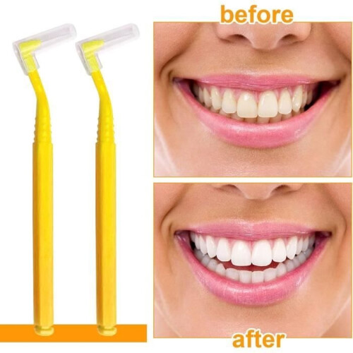 Interdental Brushes - Unspecified - Yellow - 30 Pieces - Long Handle - Dust Cap 2