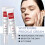 Crème tegen sproeten die melasma effectief verwijdert 3